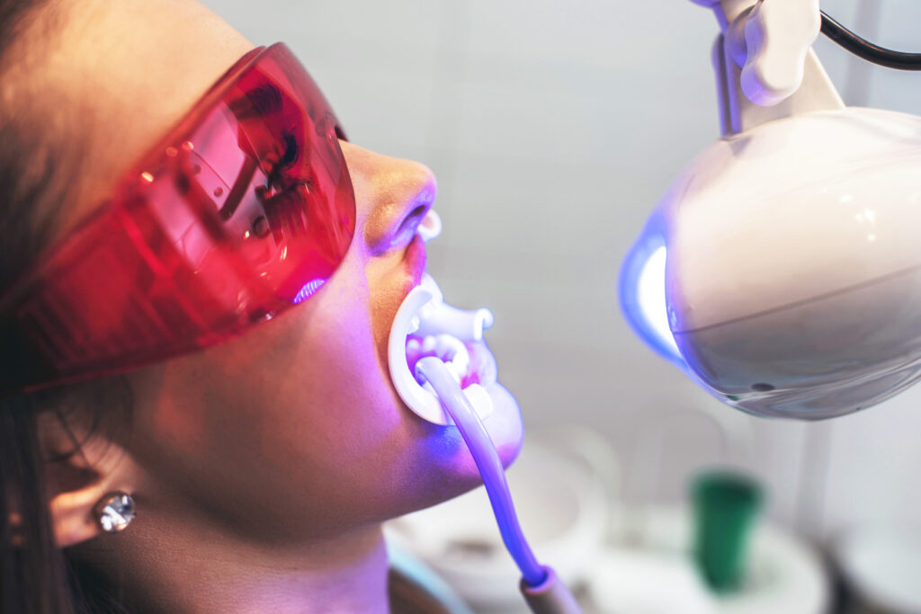 Things dentists wish knew about teeth whitening slow steady BraunS
